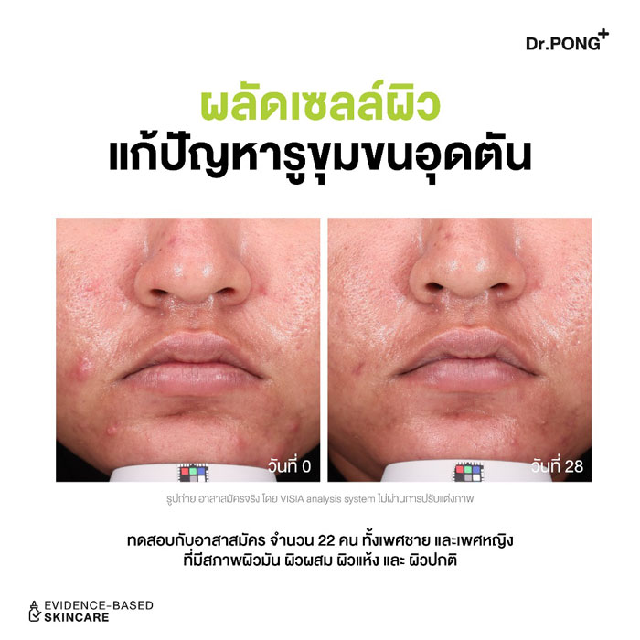 เจลล้างหน้า Dr.Pong P55 Acne Clear Face Wash