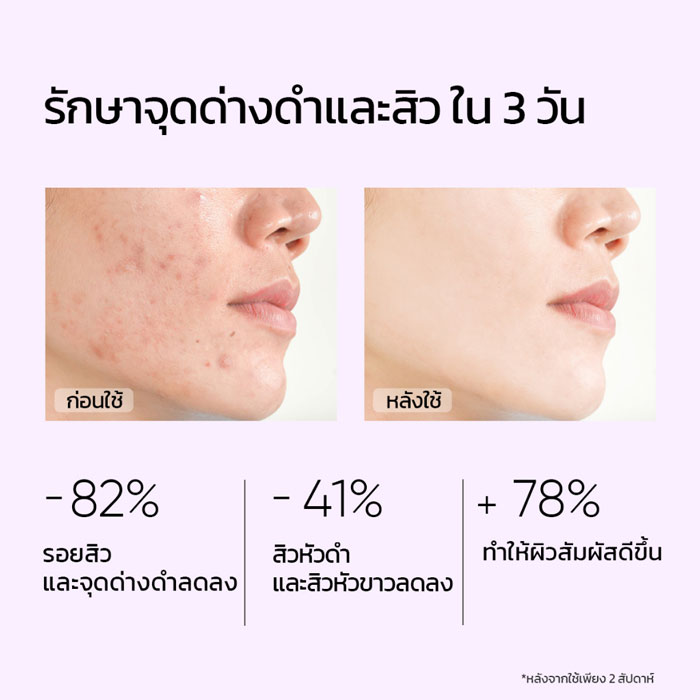 โทนเนอร์ Skintific 5% AHA BHA PHA Exfoliating Toner