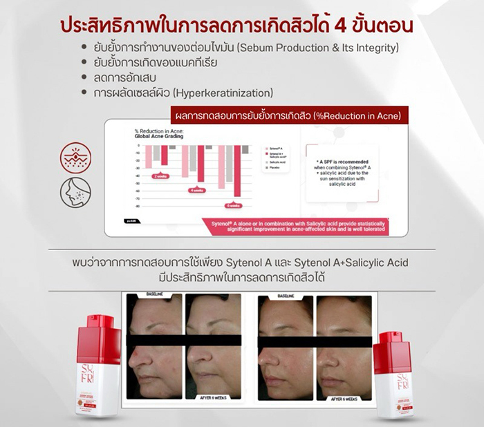 ครีมบำรุงผิวหน้า SUREFRESH SKIN Moisture Soothing Care Cream