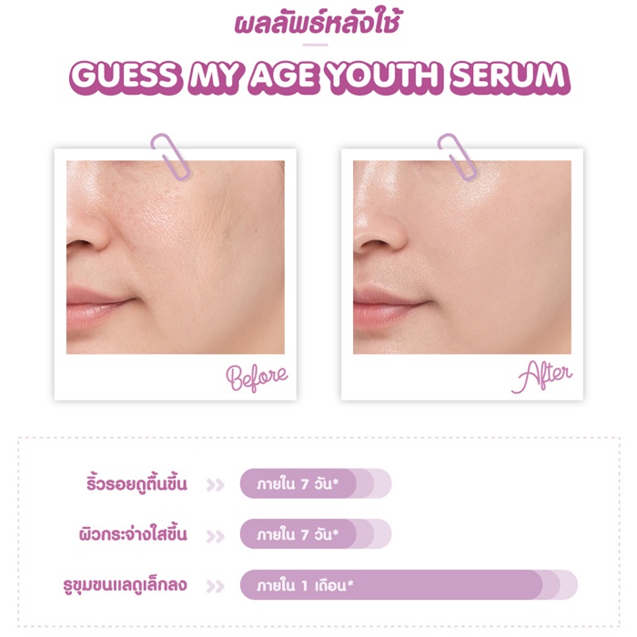 เซรั่มลดเลือนริ้วรอย Cute Press Guess My Age Youth Serum