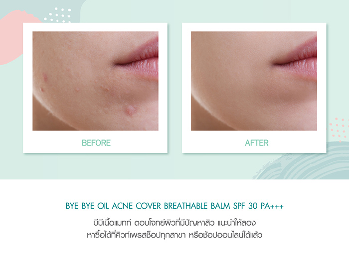 Cute Press Bye Bye Oil Acne Cover Breathable Balm SPF30/PA   