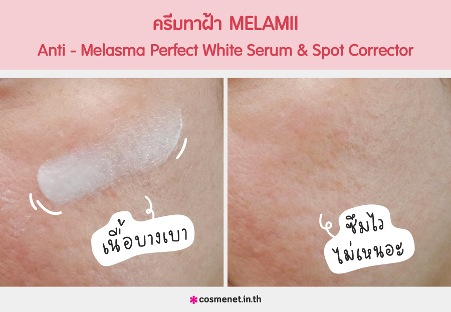 รีวิว ครีมทาฝ้า Melamii Anti-Melasma Perfect White Serum & Spot Corrector