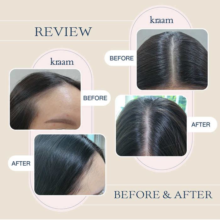 ครีมนวดผม KRAAM Hair&Scalp Revitalizing Conditioner