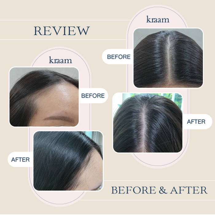 แชมพู Kraam Hair & Scalp Revitalizing Shampoo