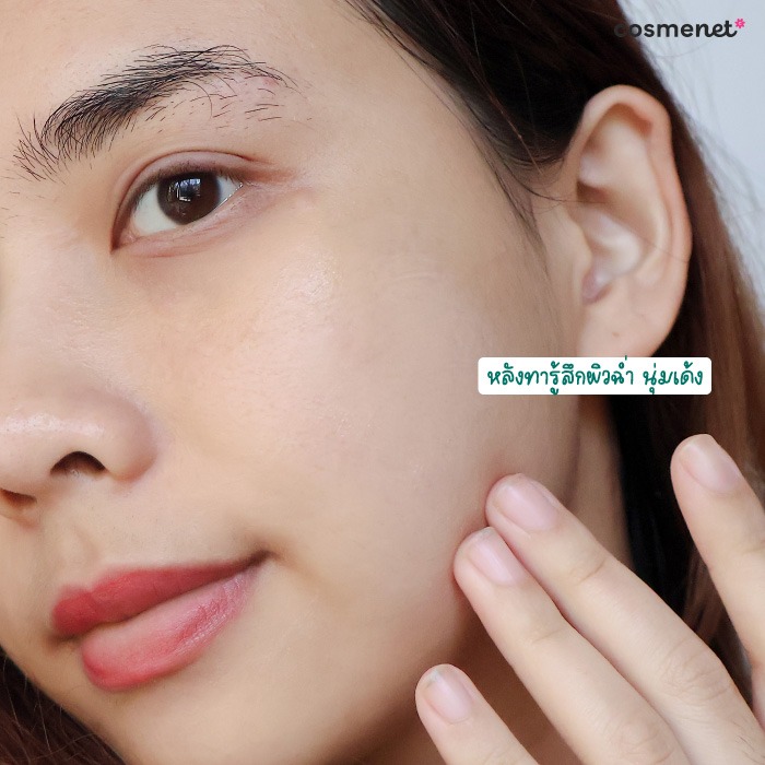 มอยซ์เจอร์ไรเซอร์ Acne-Aid Naturals Adult Acne Soothing Moisturiser