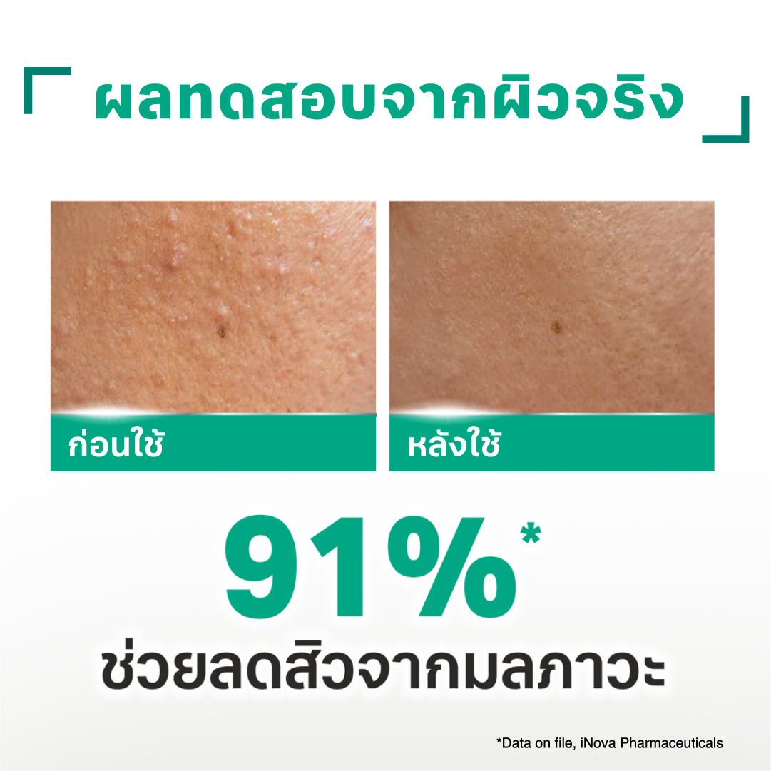 เคลนเซอร์ Acne-Aid Naturals pH Balance Deep Cleanser Pollution Acne