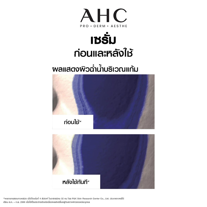 เซรั่ม AHC Pro Shot Hyaluro-Deep Volume 5 Intra-Serum