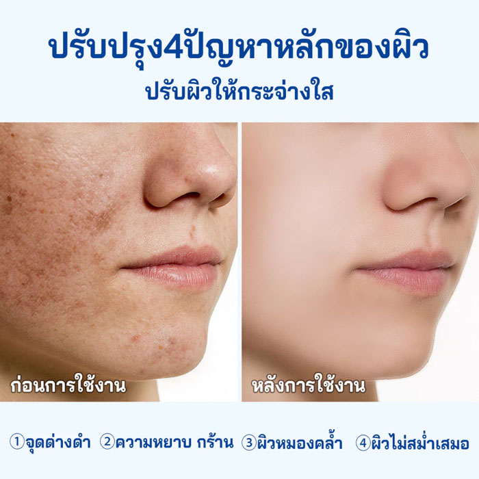 เซรั่ม Aisasea 5% Niacinamide Whitening Booster Serum