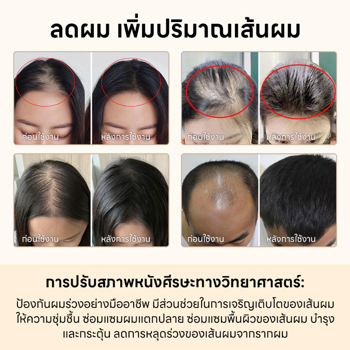 เซรั่มบำรุงผมและหนังศีรษะ Aisasea Thuja Hair Rejuvenating Serum-Anti-Hairloss Serum