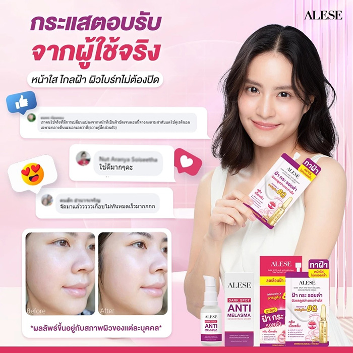 ครีมทาฝ้า Alese Dark Spot And Anti Melasma Concentrate Cream