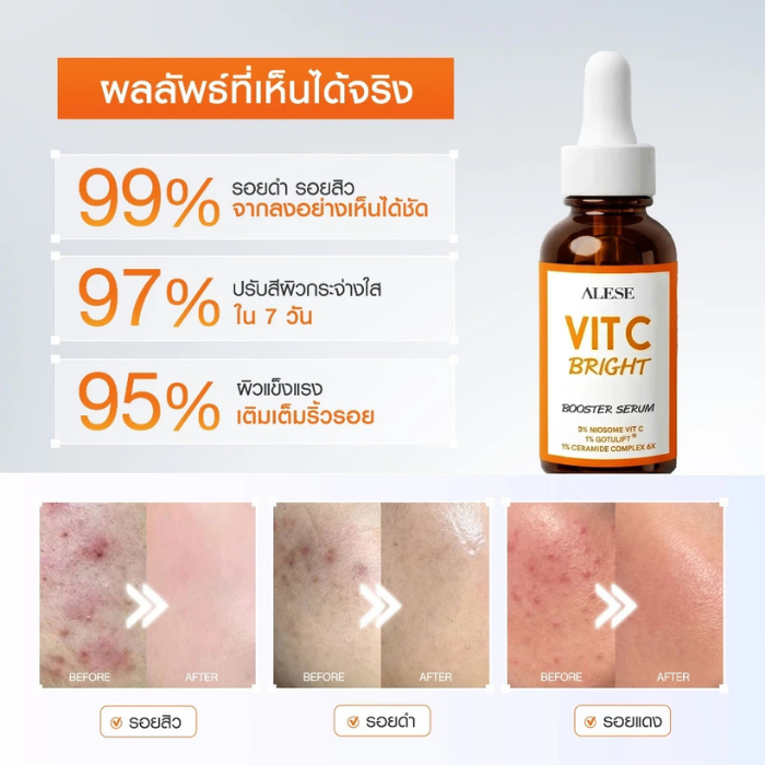 เซรั่มวิตามินซี ALESE Vit C Bright Booster Serum เซรั่มวิตามินซี ALESE Vit C Bright Booster Serum
