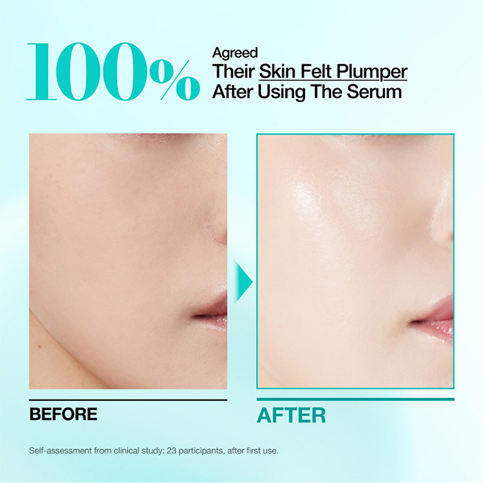 เซรั่ม ANUA PDRN Hyaluronic Acid Capsule เซรั่ม ANUA PDRN Hyaluronic Acid Capsule