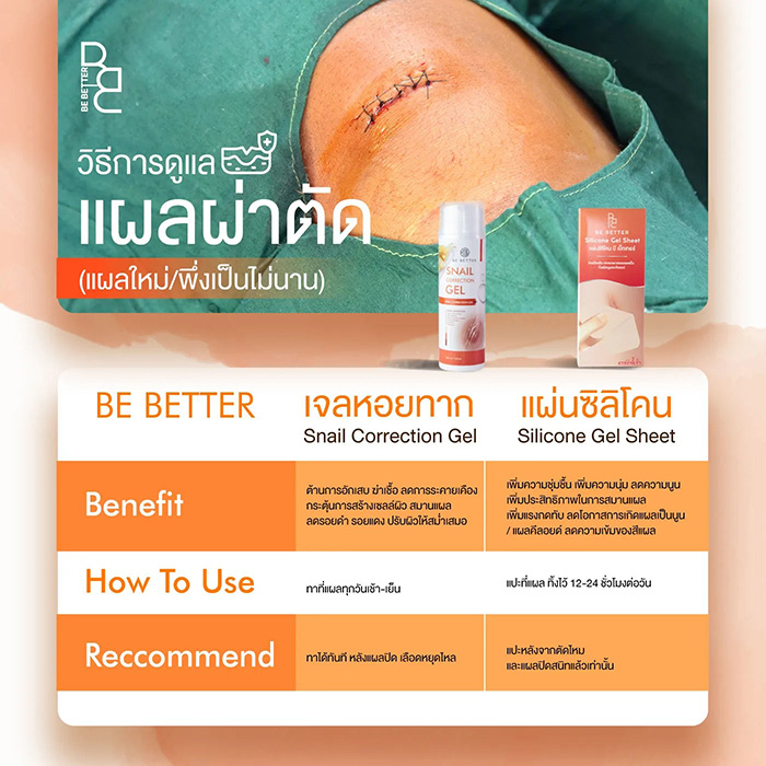 แผ่นแปะซิลิโคนลดรอยแผลเป็นนูน Be Better Silicone Gel Sheet
