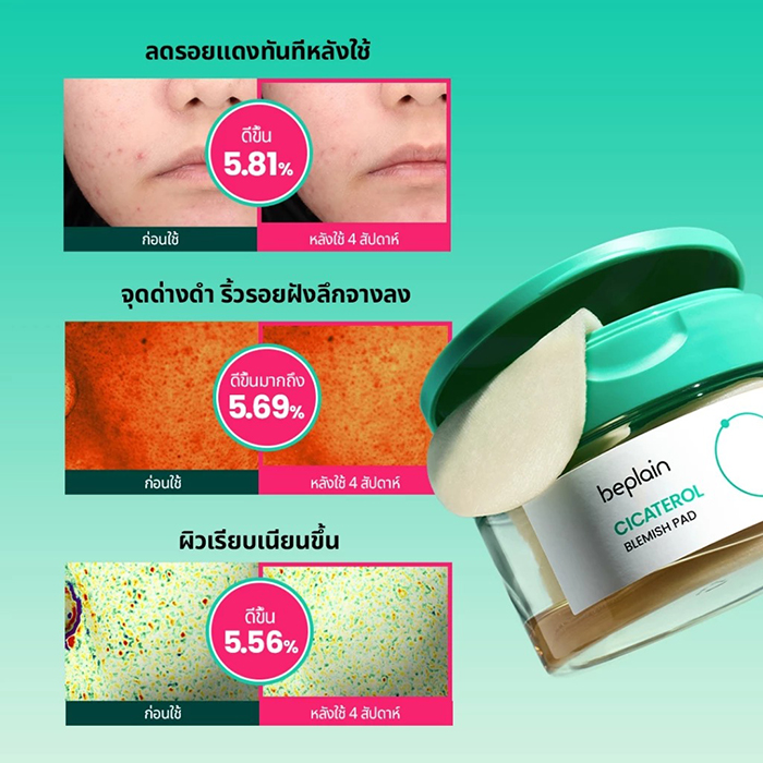 โทนเนอร์แพด Beplain Cicaterol Blemish Pad