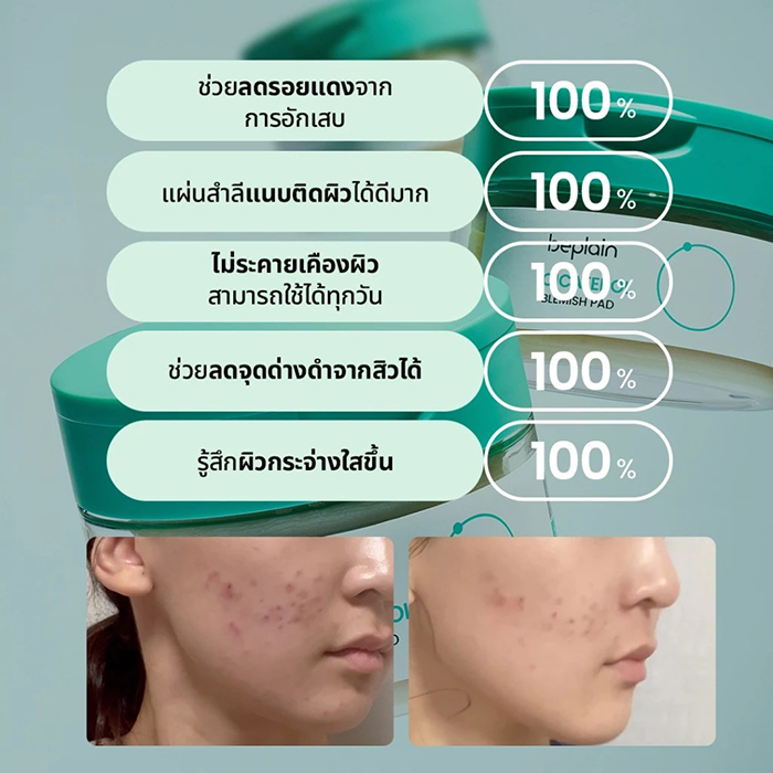 โทนเนอร์แพด Beplain Cicaterol Blemish Pad