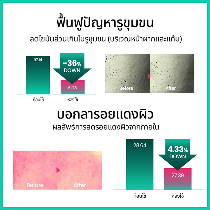 โทนเนอร์ Beplain Cicaterol Toner