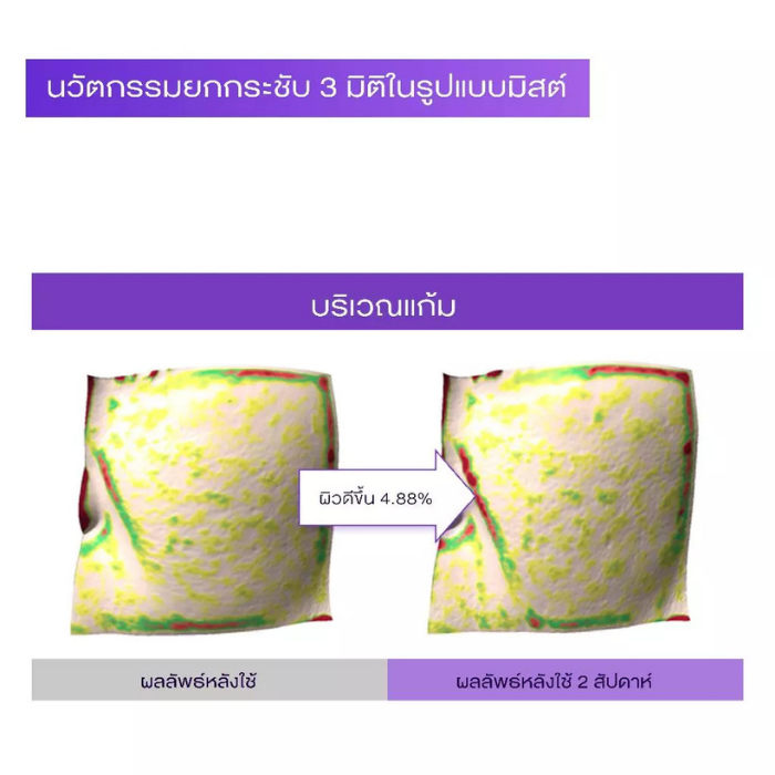 ครีมมิสต์ Bioheal Probioderm™ 3D Lifting Cream Mist ครีมมิสต์ Bioheal Probioderm™ 3D Lifting Cream Mist