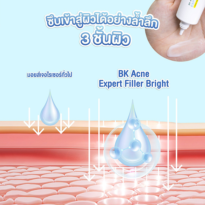 ครีมบำรุงผิวหน้า BK Acne Expert Filler Bright