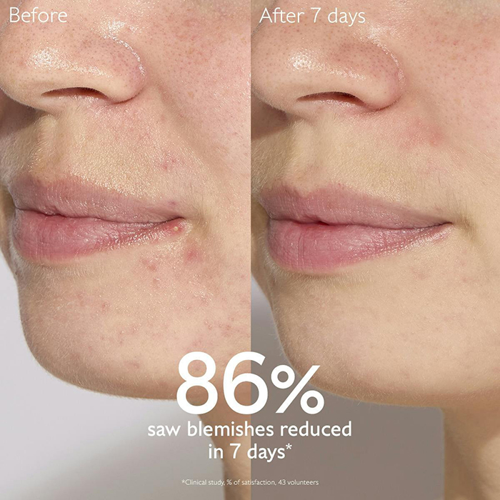 เซรั่ม Caudalie Vinopure Blemish Control Infusion Serum