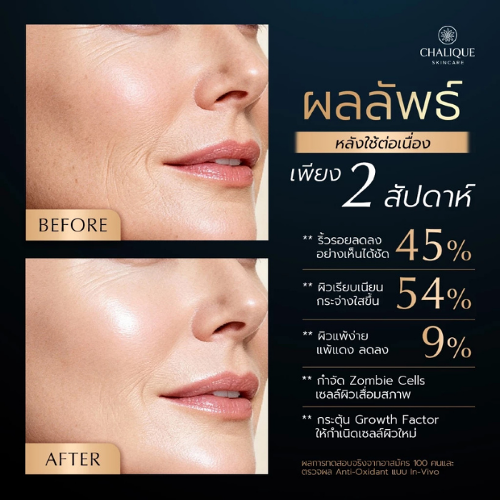 เซรั่มสเต็มเซลล์ Chalique 12 IN 1 Lifting Skin Booster Serum เซรั่มสเต็มเซลล์ Chalique 12 IN 1 Lifting Skin Booster Serum