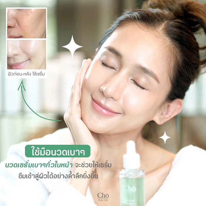 เซรั่ม Cho Skin Hyaluronic Moisture Serum Drops