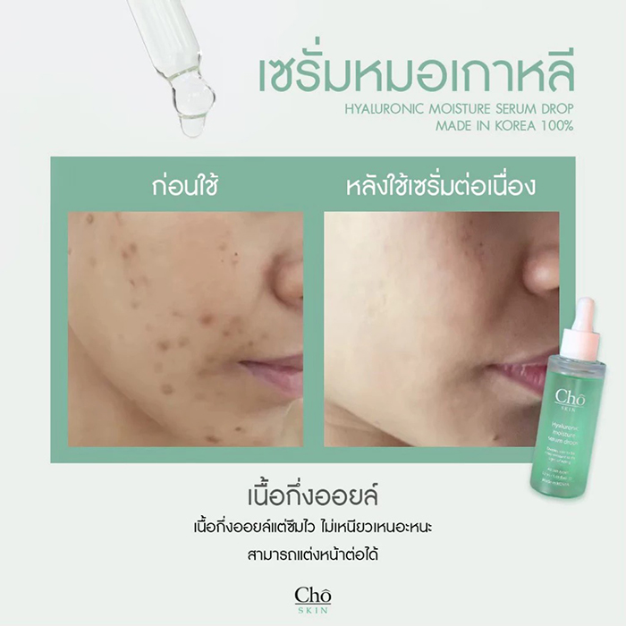 เซรั่ม Cho Skin Hyaluronic Moisture Serum Drops