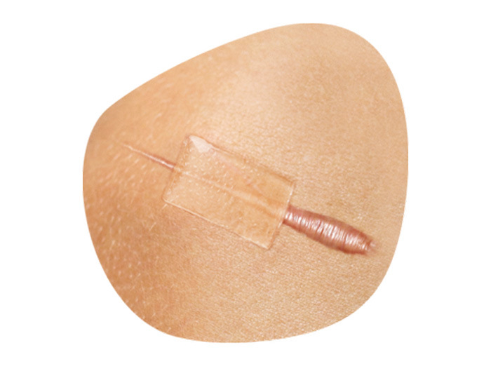 แผ่นแปะซิลิโคนลดรอยแผลเป็นนูน CICA CARE Silicone Gel Sheet