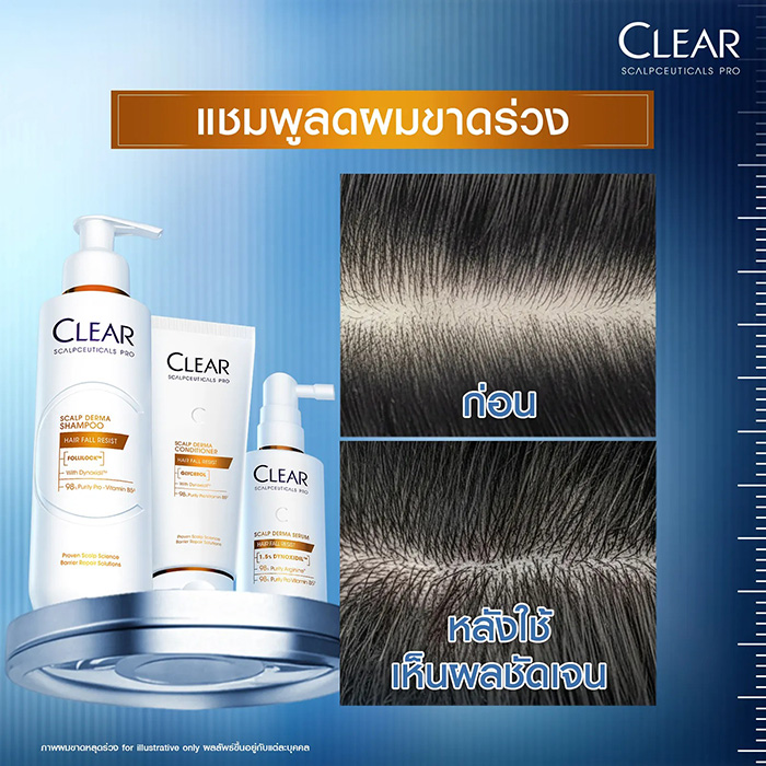 ครีมนวดผม Clear Saclpceuticals Pro Scalp Derma Conditioner Hair Fall Resist ครีมนวดผม Clear Saclpceuticals Pro Scalp Derma Conditioner Hair Fall Resist