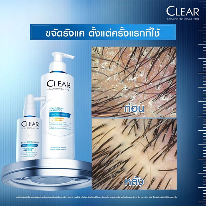 แชมพูขจัดรังแค Clear Saclpceuticals Pro Scalp Derma Shampoo Dandruff Rescue