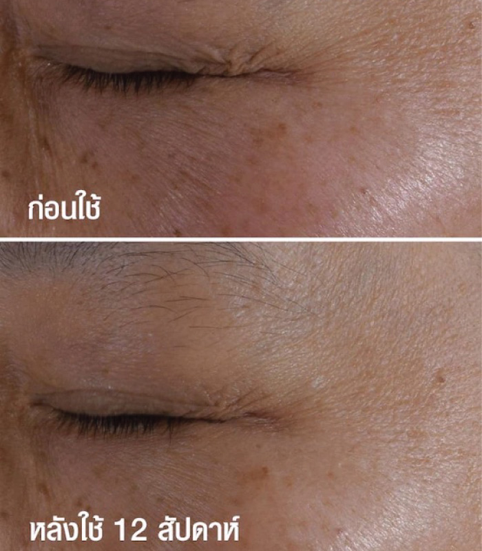 อายครีม Clinique Smart Clinical Repair Wrinkle Correcting Eye Cream