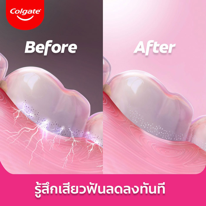 Colgate Salt Sensitive Relief ยาสีฟัน