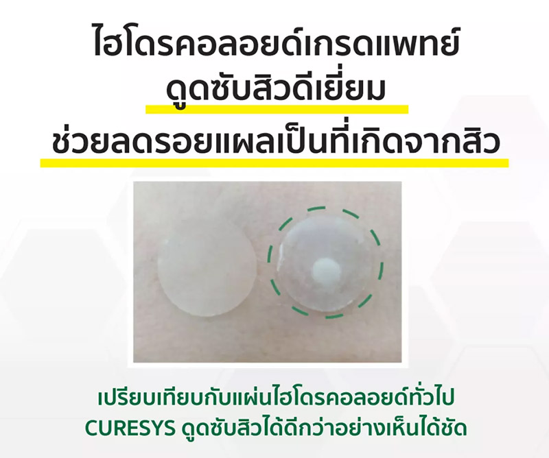 แผ่นดูดสิว ลดรอย Curesys Niacin Acvita White Patch