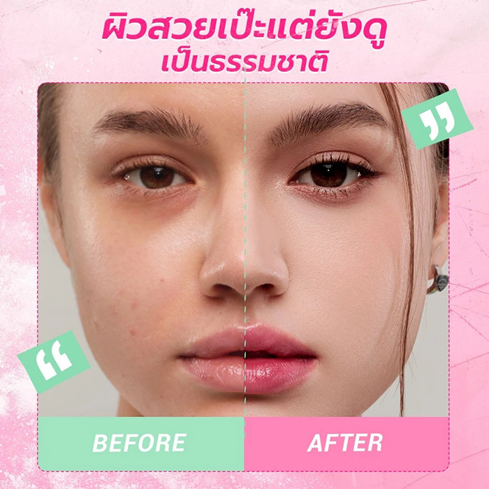 รองพื้นสกินทินท์ DAZZLE ME Acne Armor Cover & Correct Skin Tint