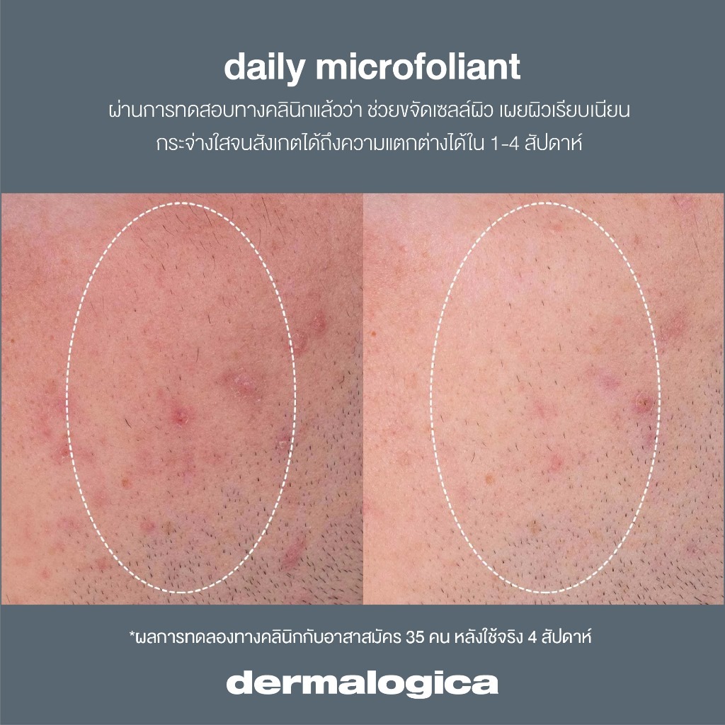 ผงสครับ Dermalogica Daily Microfoliant