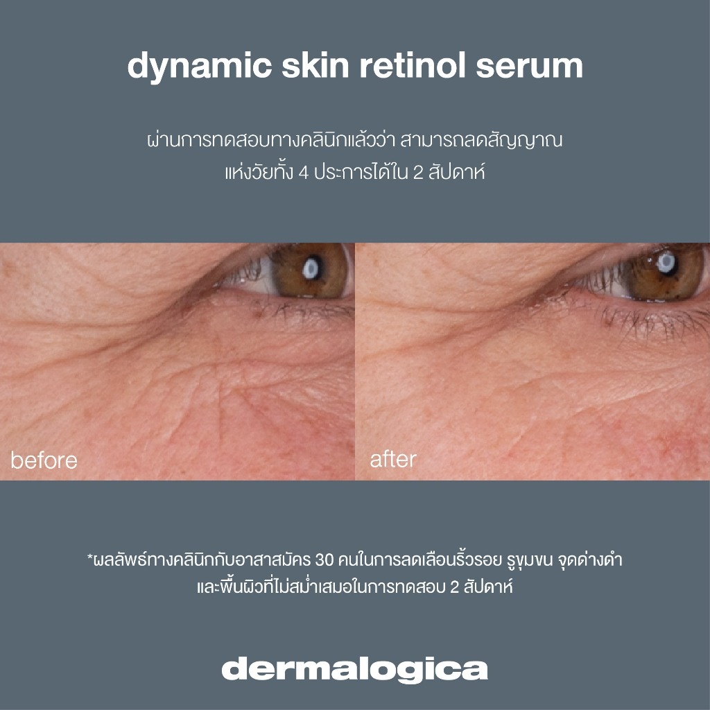 เซรั่มบำรุงผิว Dermalogica dynamic skin retinol serum