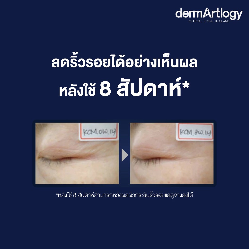 เซรั่ม Dermartlogy ATG Ulreasoothe Rejuvenating Serum
