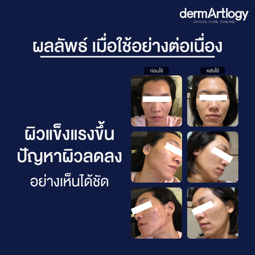 เซรั่ม Dermartlogy ATG Ulreasoothe Rejuvenating Serum
