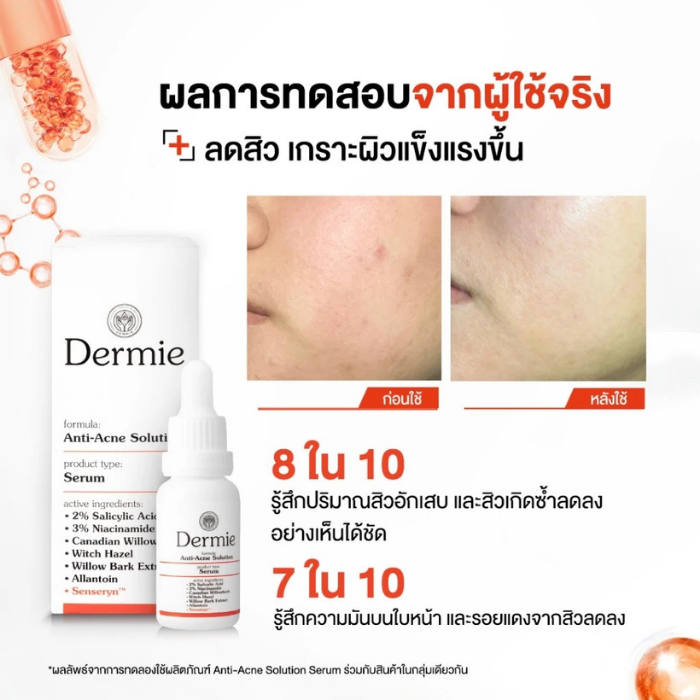 เซรั่ม Dermie Anti-Acne Solution Serum