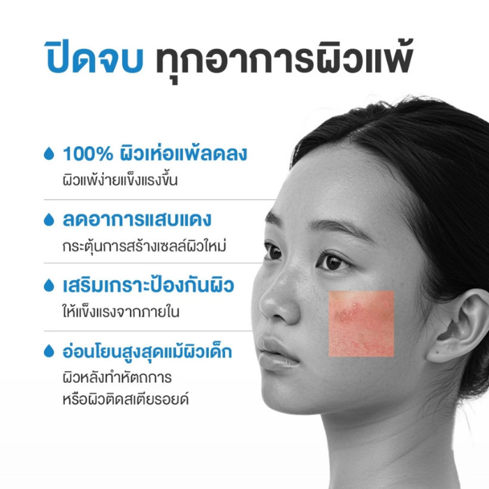 มอยเจอรไรเซอร์ Dermie B5 Soothing Solution Moisturizer
