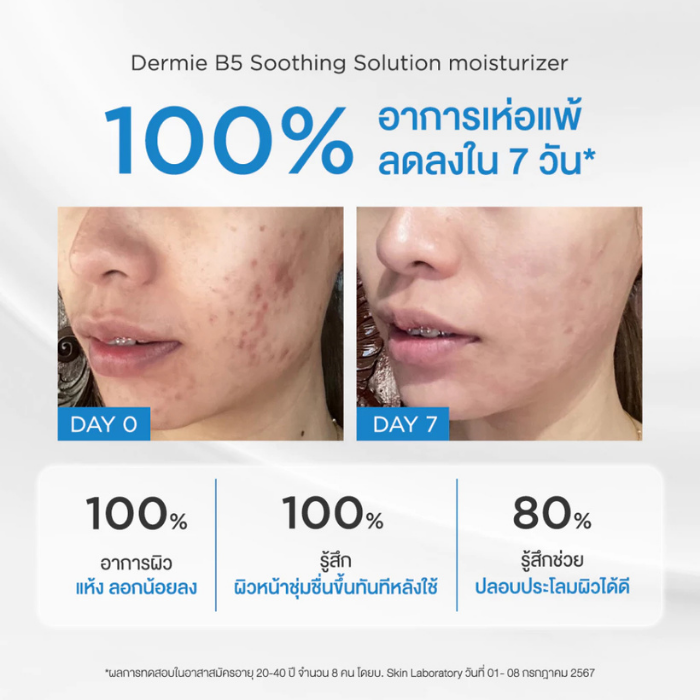 มอยเจอรไรเซอร์ Dermie B5 Soothing Solution Moisturizer