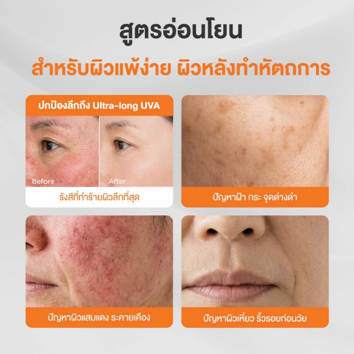 กันแดดเวชสำอาง Dermie UV Protection SPF50+ PA++++ กันแดดเวชสำอาง Dermie UV Protection SPF50+ PA++++