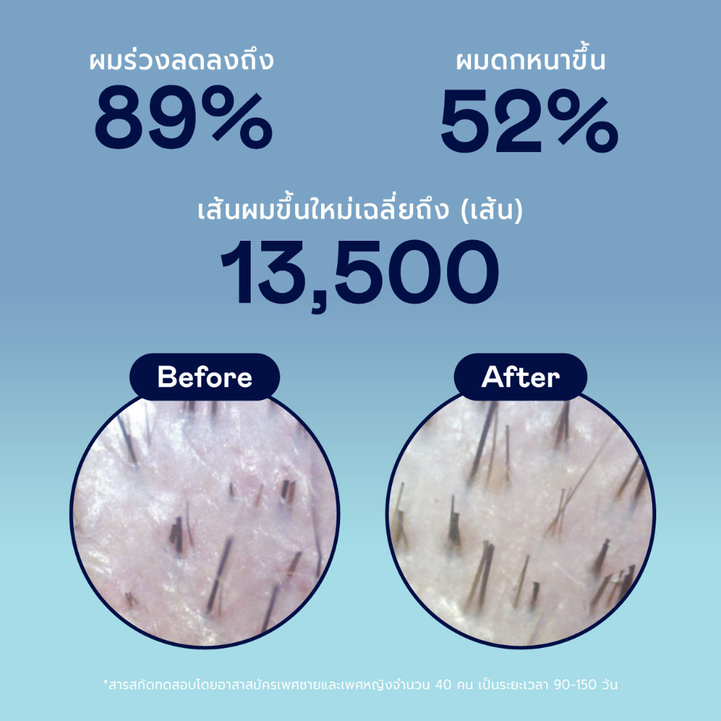 เซรั่มบำรุงผม Divyne Strand Saviour Intensive Hair Serum