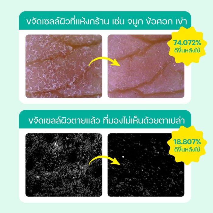 สครับ Dr.G Brightening Peeling Gel