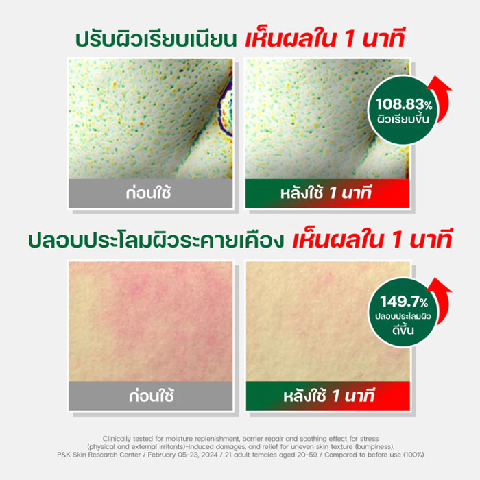 มาส์ก Dr.G R.E.D BLEMISH Quick PHA Mask