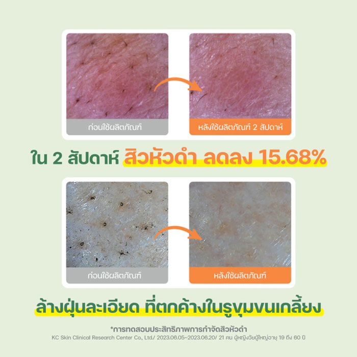 คลีนซิ่งออยล์ Dr.G Green Deep Cleansing Oil