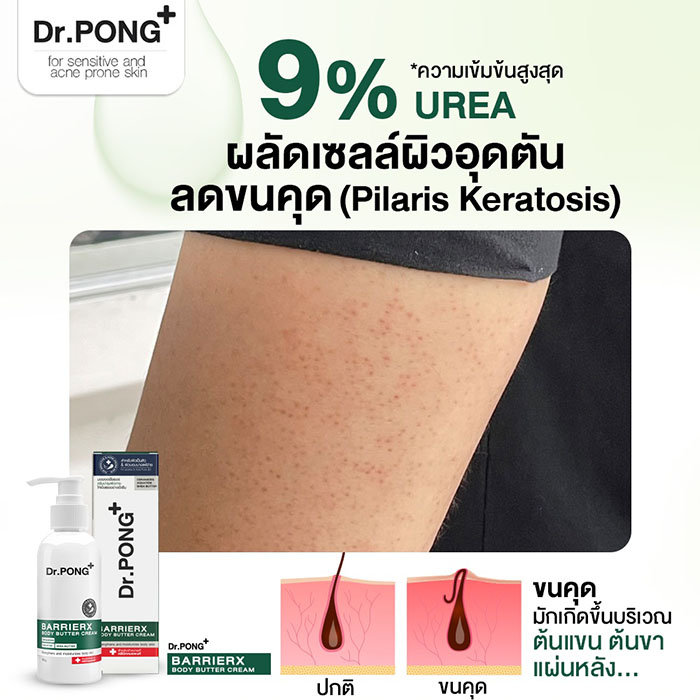 โลชั่นผิวกาย Dr.PONG Barrier X Body Butter Cream - UREA 9%