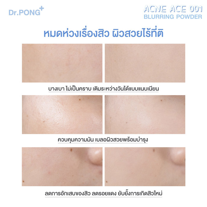 Dr.Pong Acne Ace 001 Blurring Powder แป้งไม่ผสมรองพื้น