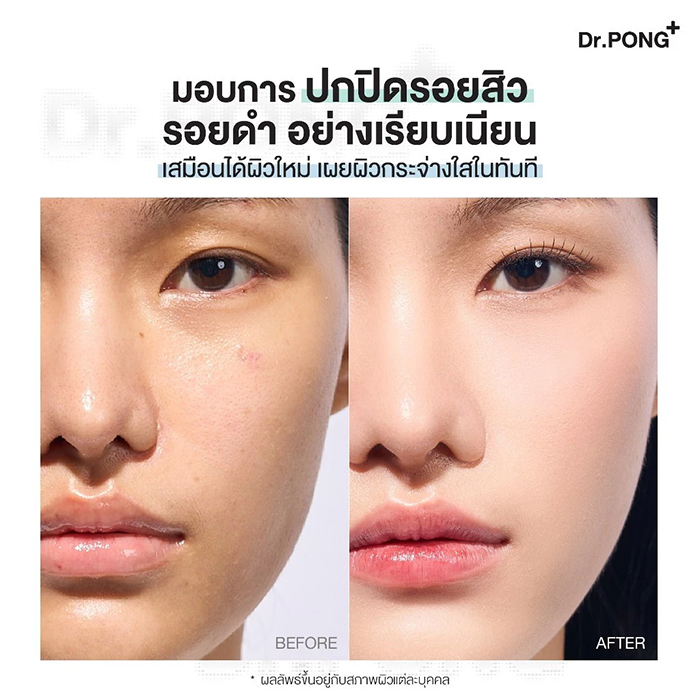 คุชชั่น Dr.PONG ACNE ACE Longwear Cushion