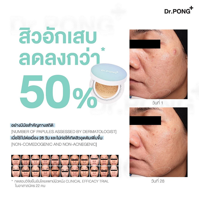 คุชชั่น Dr.PONG ACNE ACE Longwear Cushion