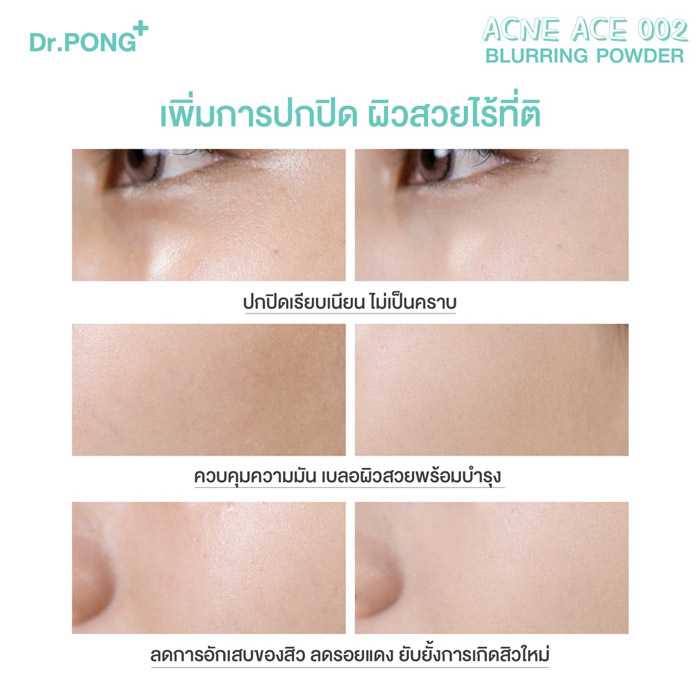 Dr.Pong Acne Ace 002 Blurring Powder แป้งผสมรองพื้น